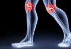 Анатомија на коленото зглоб