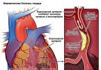 Клиника и диагностика ишемической болезни сердца