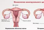 ประจำเดือนมาช้า แต่ผลตรวจเป็นลบ จะทำอย่างไร?